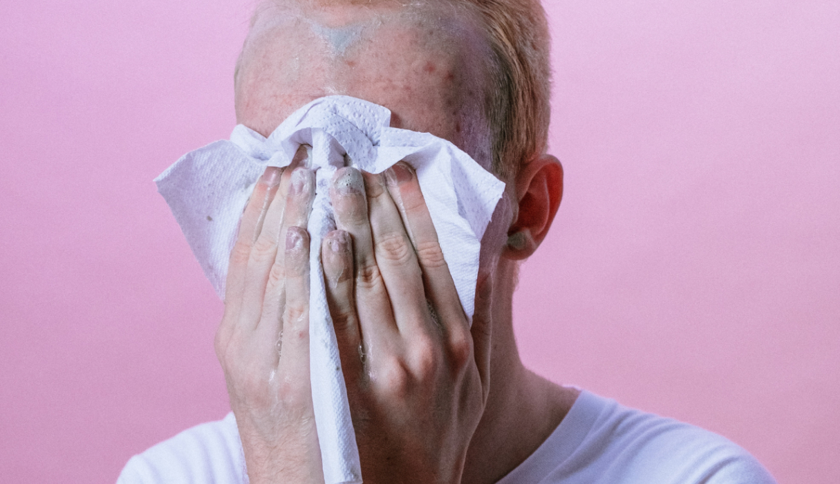 jongen met acne